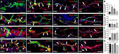 Distinct Fibroblast Lineages Give Rise to NG2+ Pericyte Populations in Mouse Skin Development and Repair